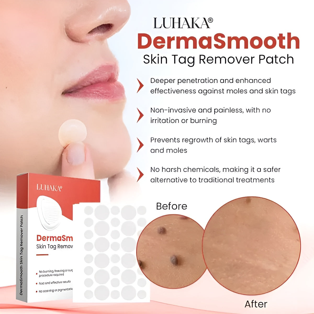 DermaSmooth - Skin Tags & Pimple Removal Patches - 72 Pieces